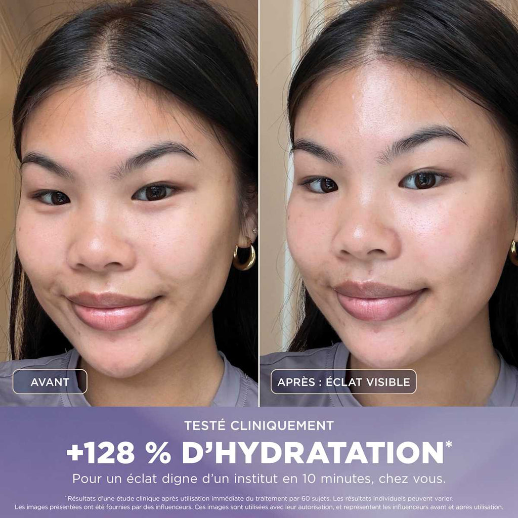 Appareil de soin du visage hydrofacial à domicile Shark FacialPro Glow + DePuffi - Lilas Doux
