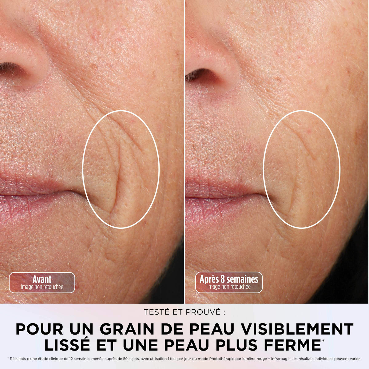 Pack Masque LED CryoGlow Shark avec rafraîchissement du contour des yeux et Stand de recharge